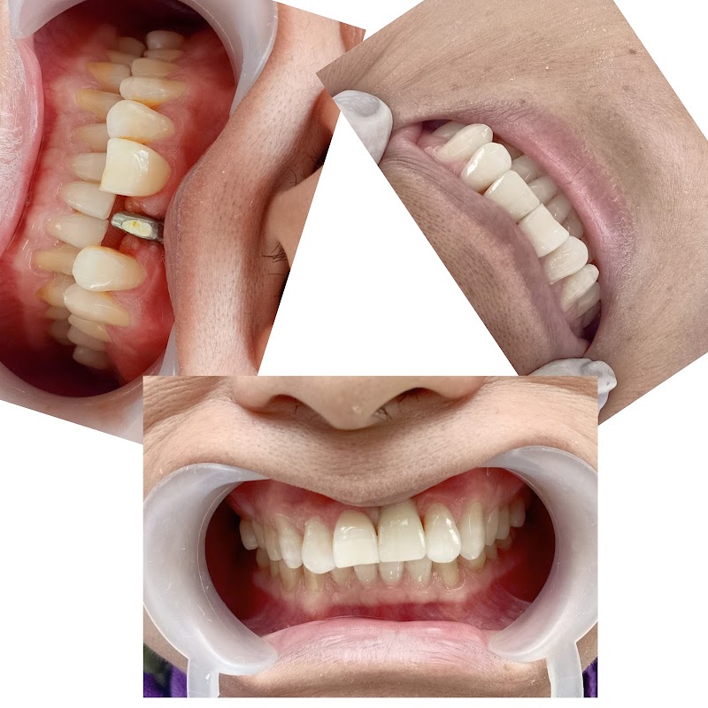 NHA KHOA QUỐC TẾ VIỆT ĐỨC