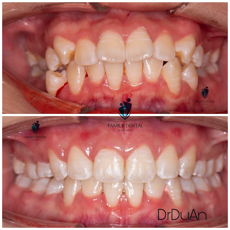 Nha Khoa Family Ninh Bình