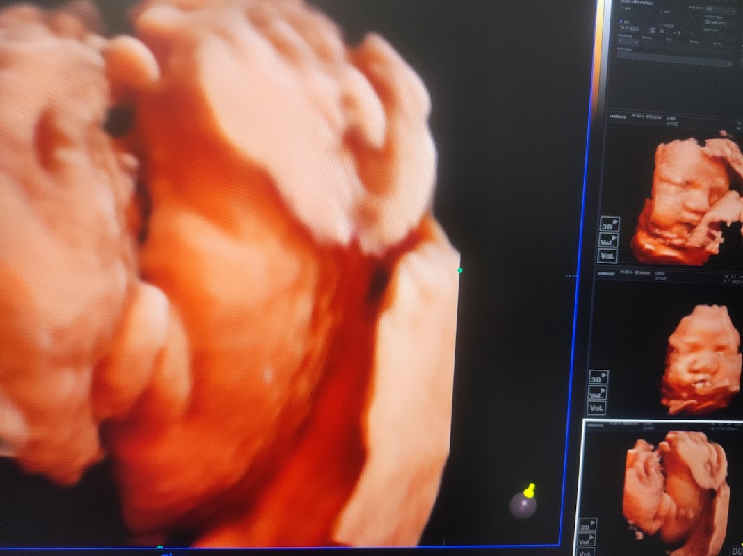 Phòng khám Sản Phụ Khoa BS Hạnh ⭐⭐⭐⭐⭐