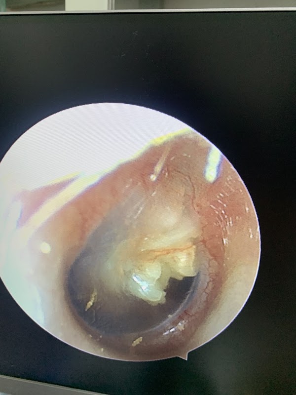 Phòng khám tai mũi họng bác sỹ Nguyễn Ngọc Phấn, BsTMH Bv ĐHY Hà Nội