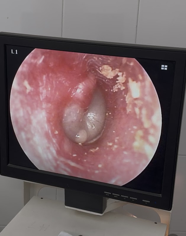 Phòng khám Tai Mũi Họng – BS Nguyễn Mạnh Tiến