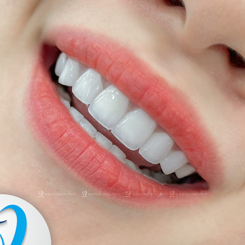 Nha Khoa Long Xuyên