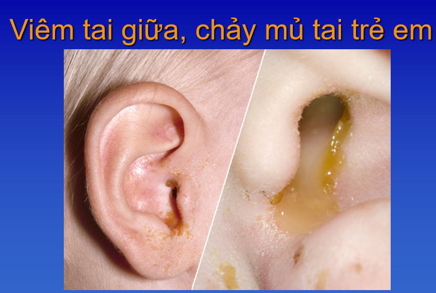 Phòng Khám Tai Mũi Họng BS. Nguyễn Anh Quỳnh