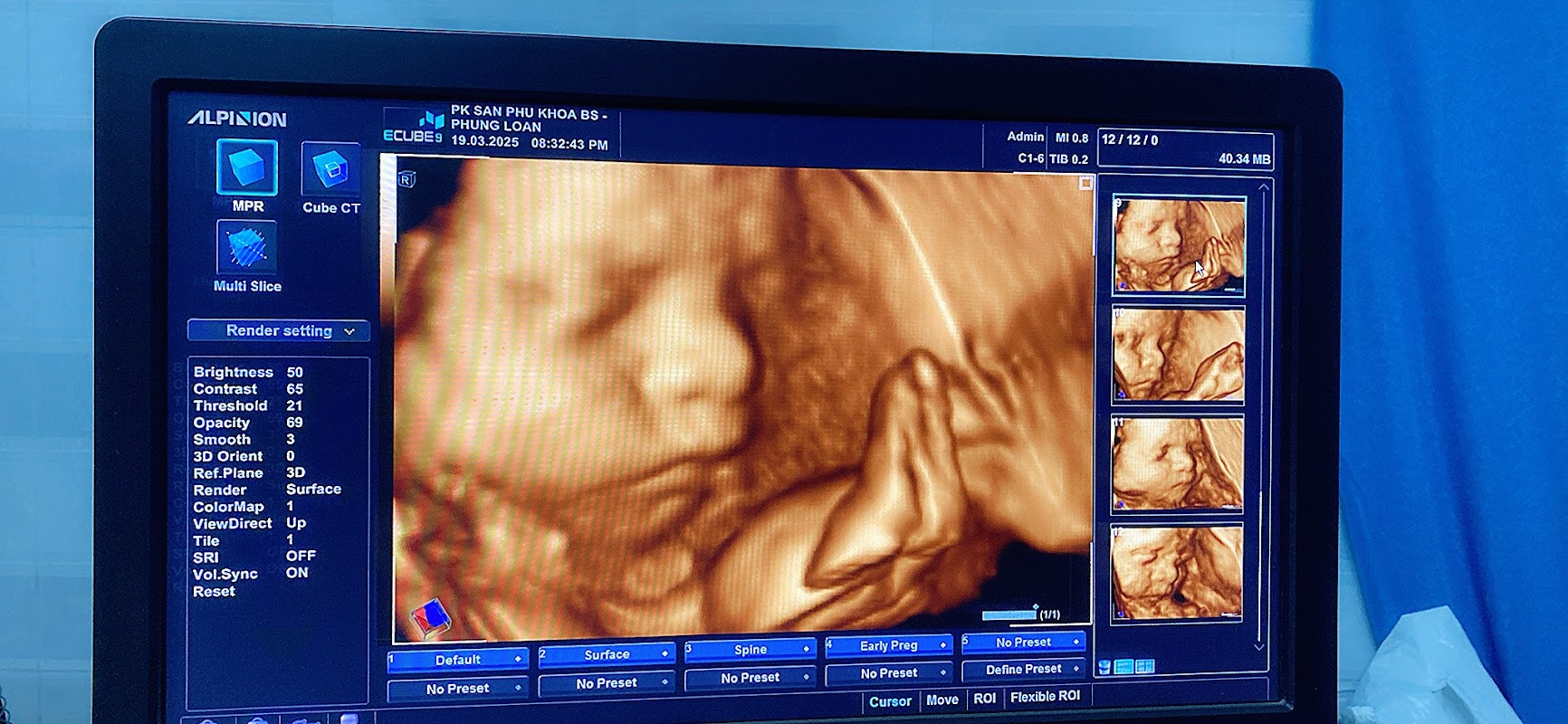 PHÒNG KHÁM SẢN PHỤ KHOA – HIẾM MUỘN SIÊU ÂM THAI 4D 5D BÁC SỸ CHUYÊN KHOA 1: MAI THỊ PHỤNG LOAN