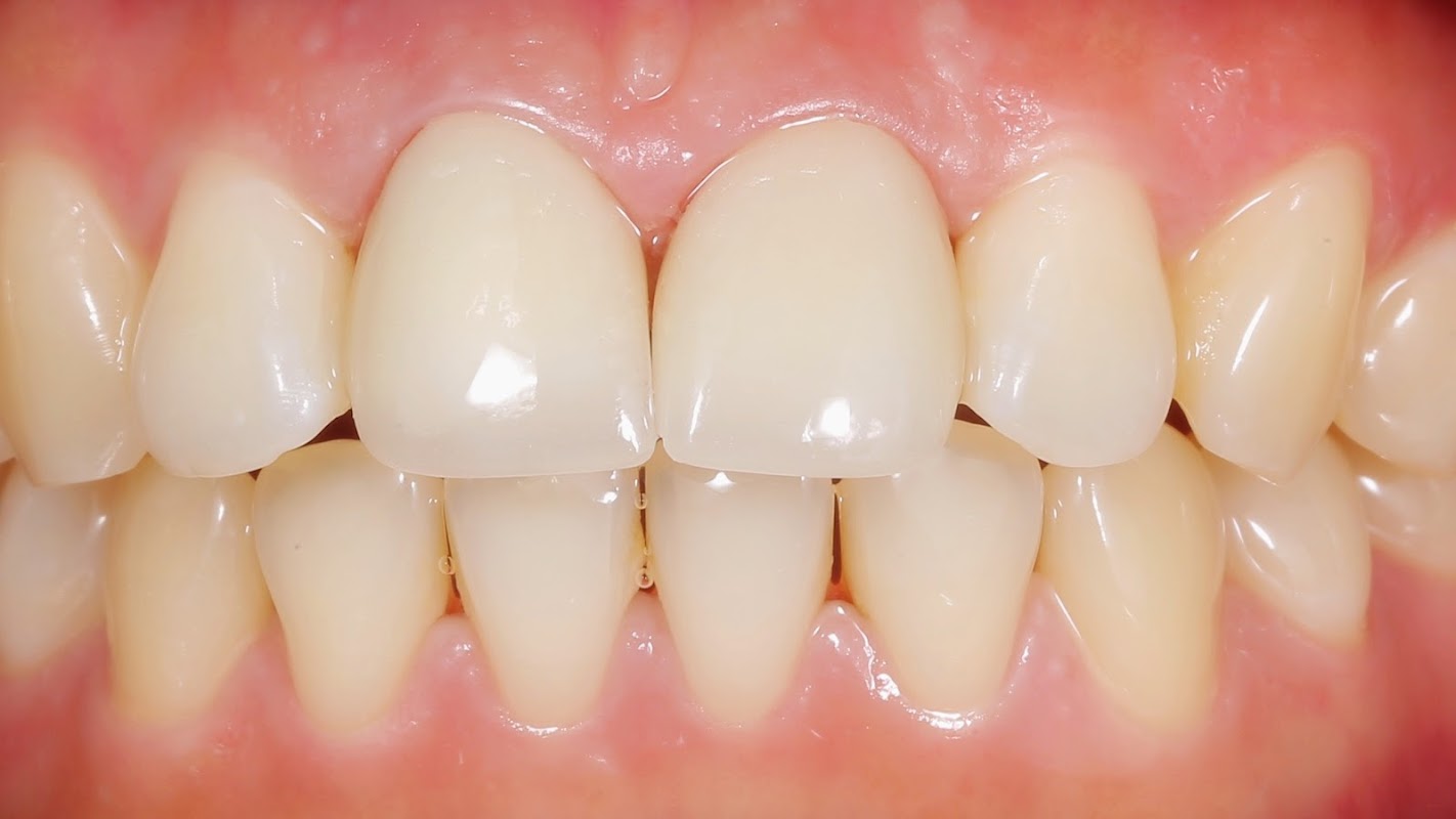 Nha Khoa – Bs Đinh Văn Ba – Nha Khoa Long An